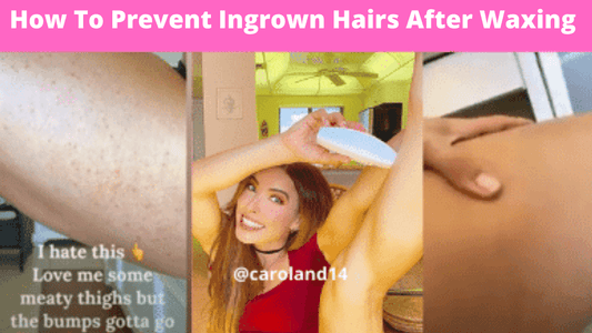 How To Prevent Ingrown Hairs After Waxing