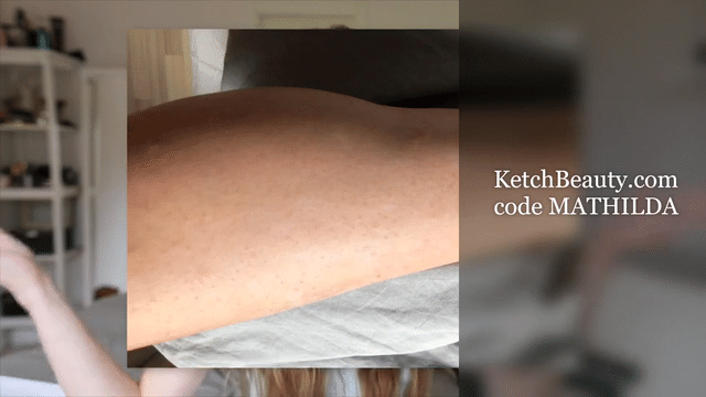 ketchbeauty ipl results