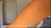 KetchBeauty V4.1 IPL Hair Removal Handset
